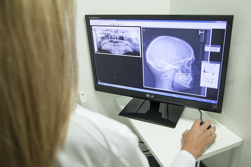 Trial Team Shows Reality Of Brain Injury